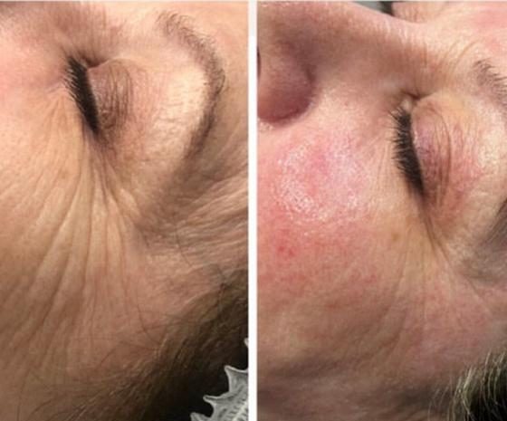 two people in a counseling session one person holding a clipboard focused on mental health discussions relating to three aspects of therapy