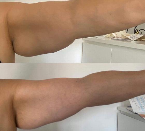 female figure measuring waist with tape against blue background showcasing body positivity and fitness for 4 different measurements