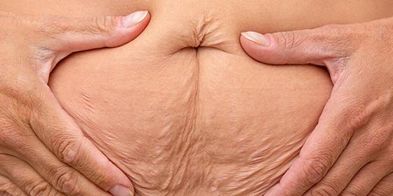 before and after image showing skin improvement on the arm enhanced appearance and elasticity techniques used for better results