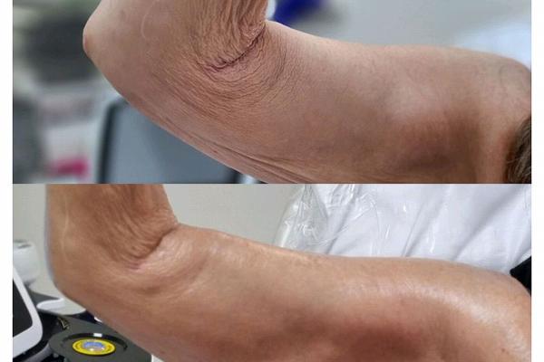 body sculpting company in ware and hertfordshire