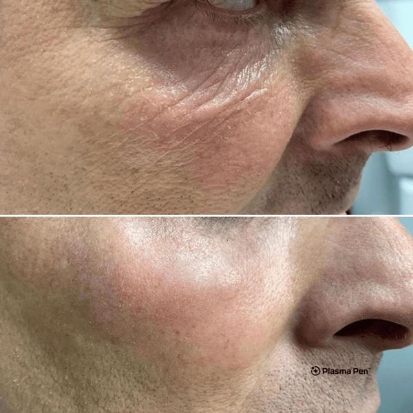 body sculpting company in ware and hertfordshire